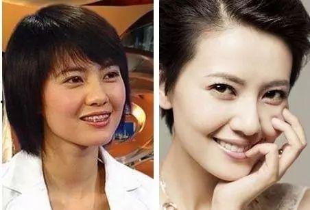 明星都是在哪整的容,探寻明星美容秘密基地